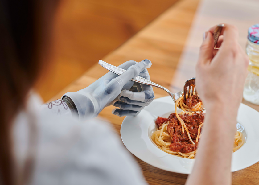 Frau mit Prothesenhand sitzt am Tisch und isst Spaghetti